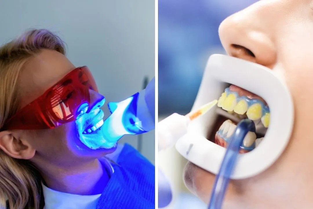 آیا بلیچینگ به دندان آسیب می‌زند؟ حقایقی که باید بدانید